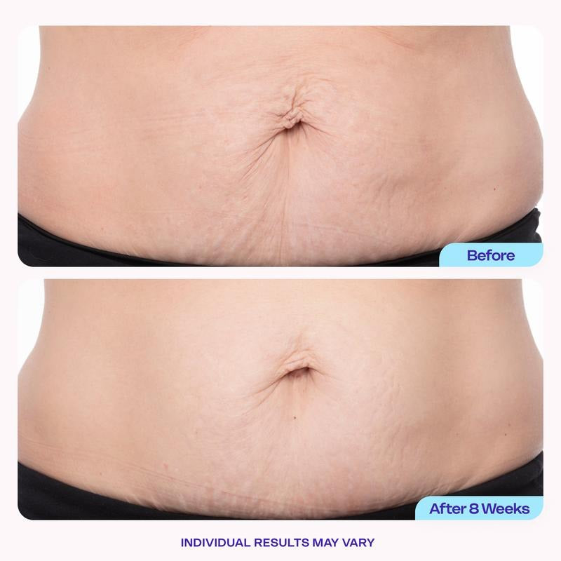 Before and after 8 weeks