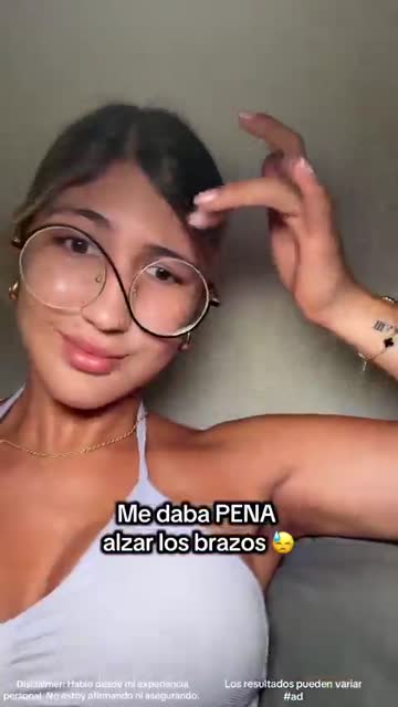 Creator showing her arms after using Peel Shot